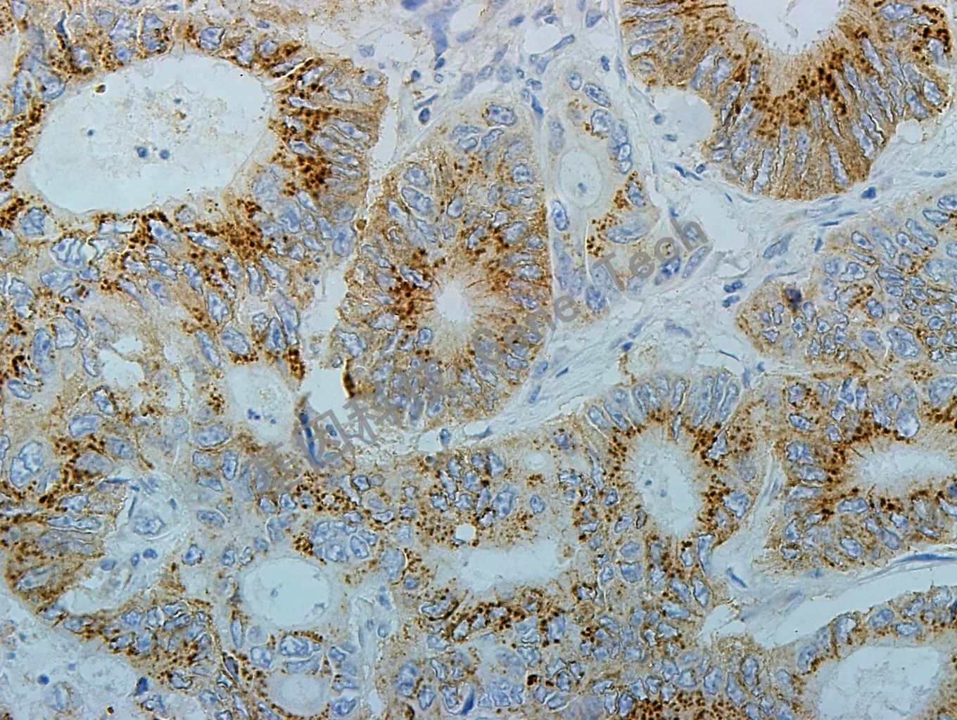 1616899118382282.jpg 1616899118382282.jpg