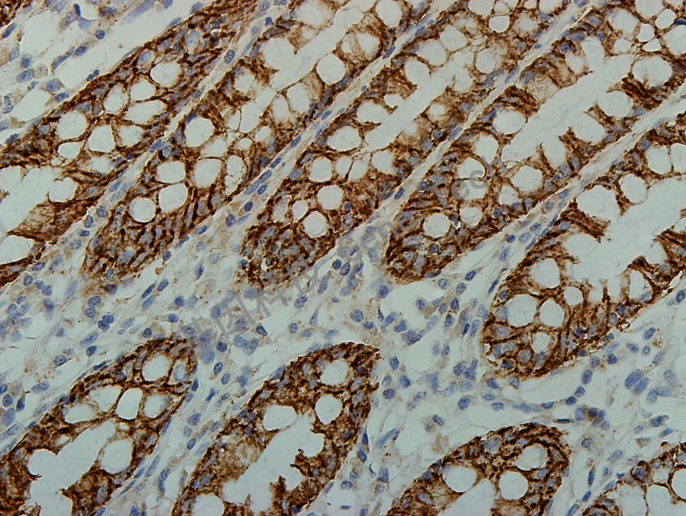 1625747984533733.jpg 1625747984533733.jpg