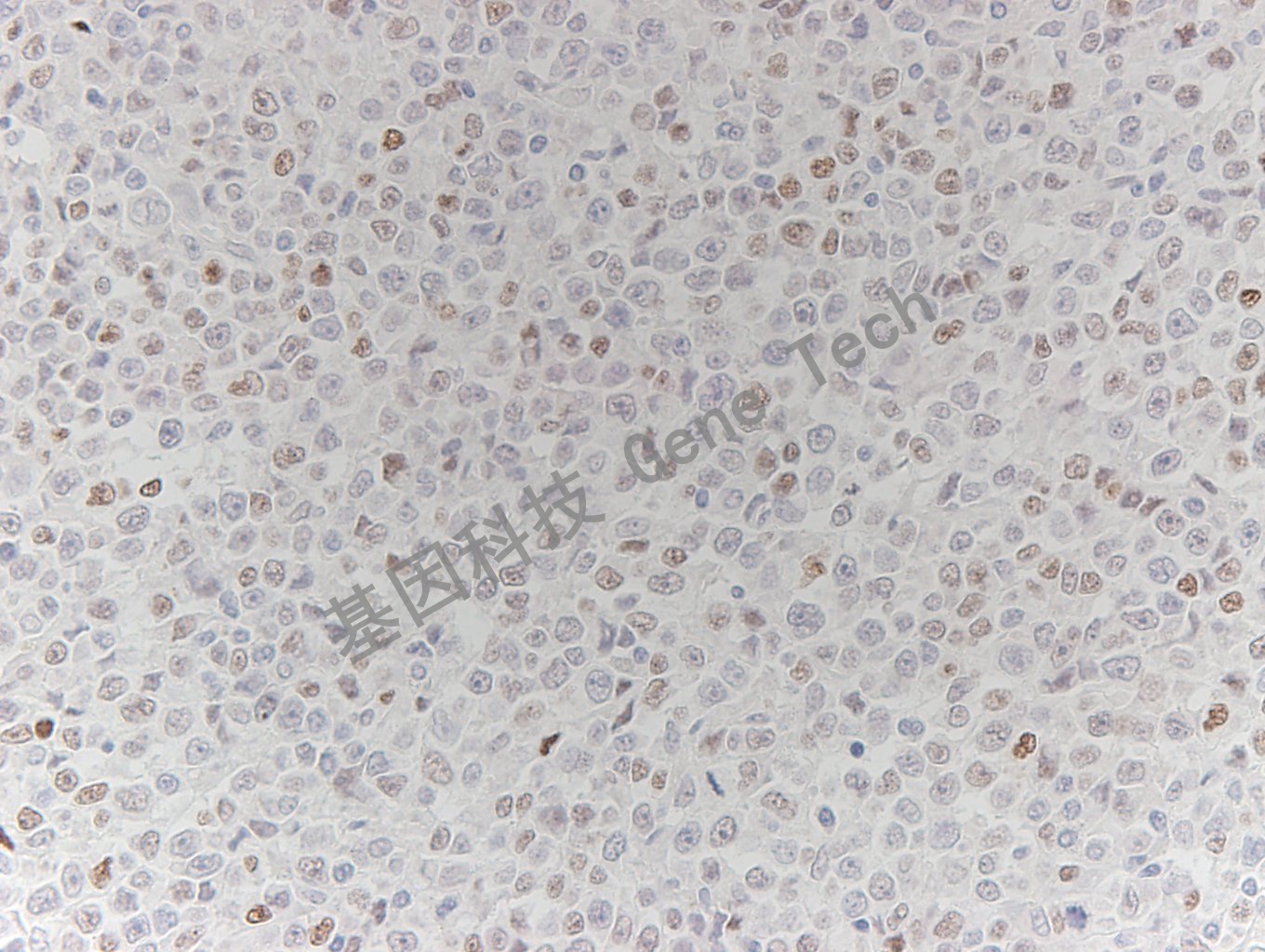 1625805658214299.jpg 1625805658214299.jpg