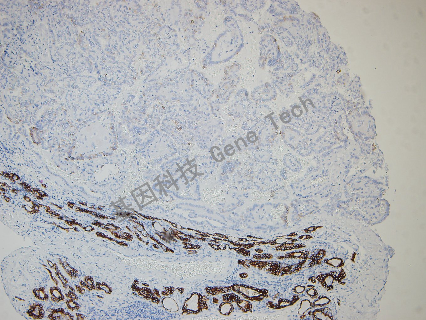 1643195015207319.jpg 1643195015207319.jpg