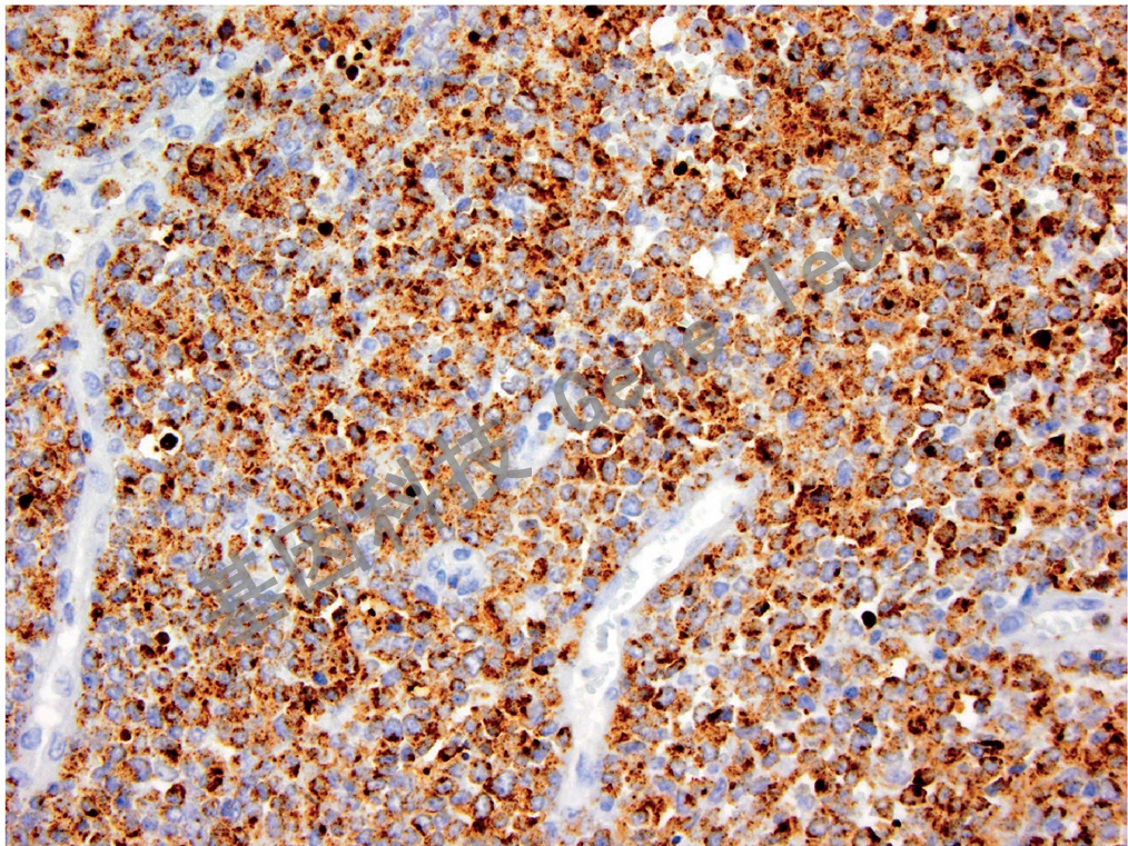 1680571514183814.jpg 1680571514183814.jpg