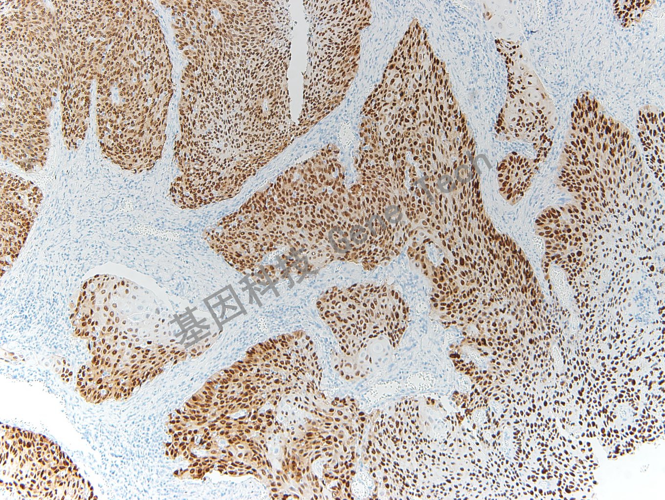 1681176867126829.jpg 1681176867126829.jpg