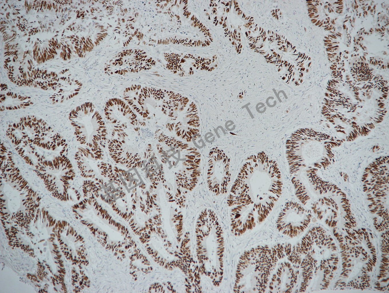 1683274860104054.jpg 1683274860104054.jpg