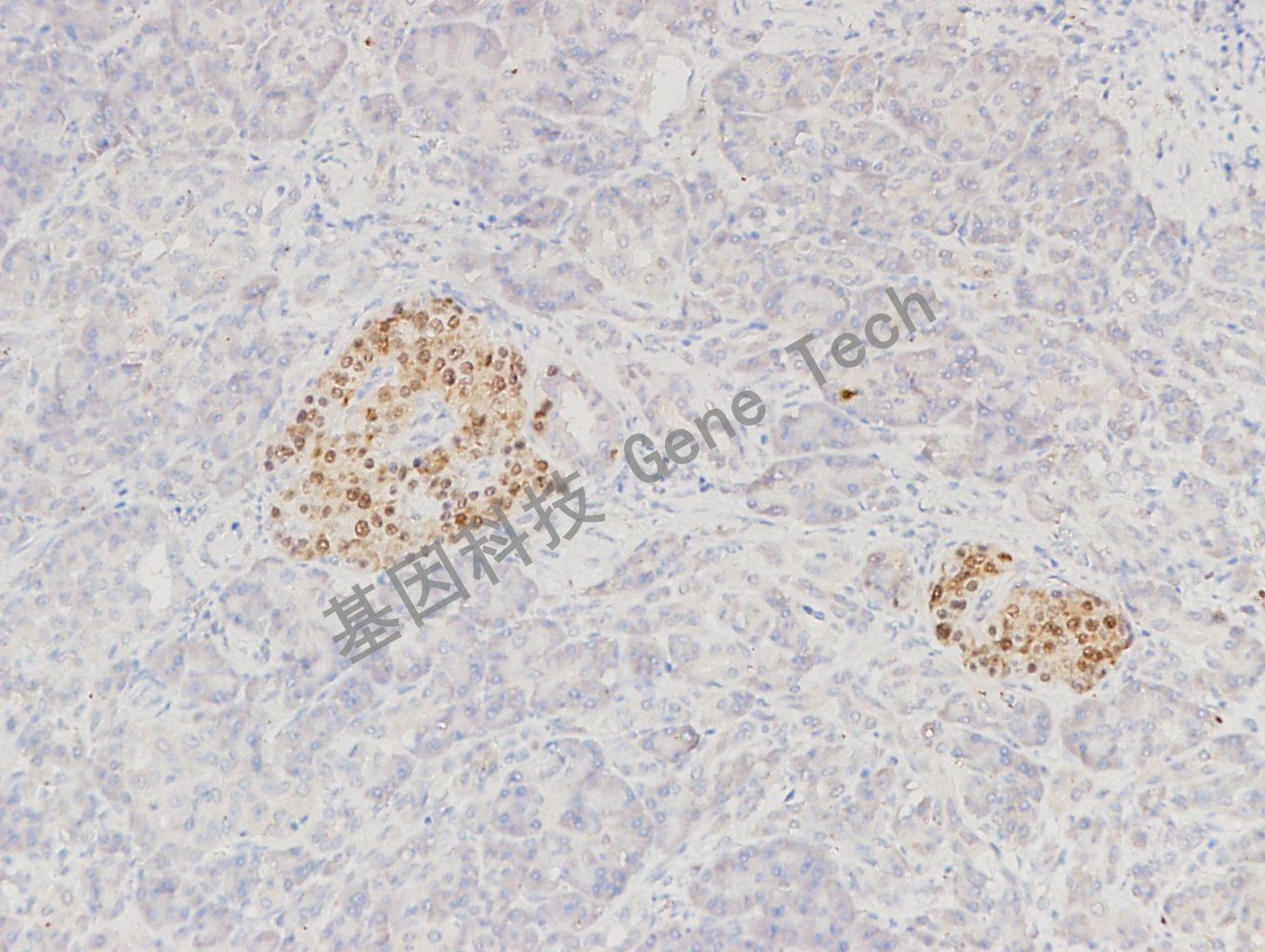 1683447548149643.jpg 1683447548149643.jpg