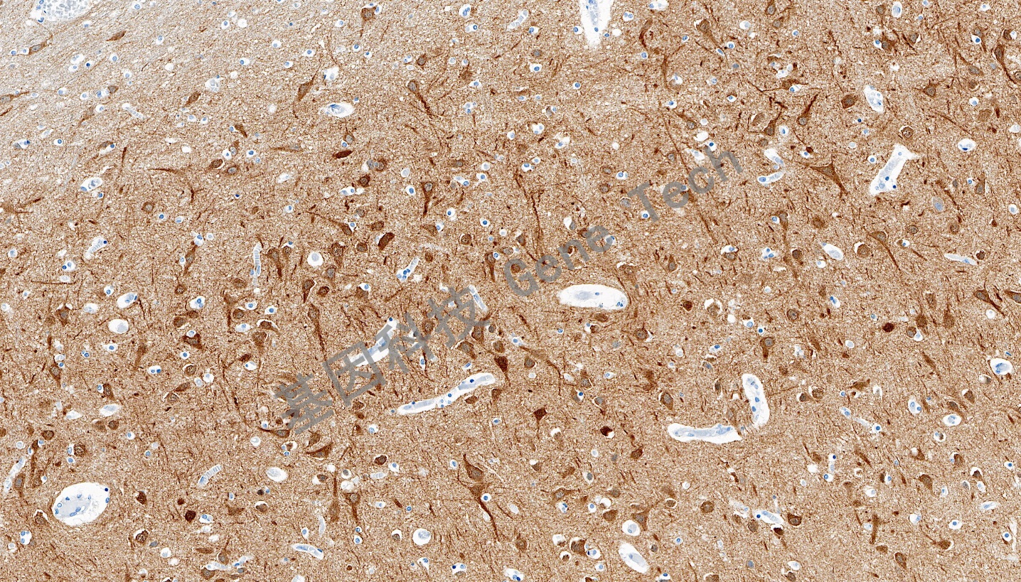 1694753085164825.jpg 1694753085164825.jpg