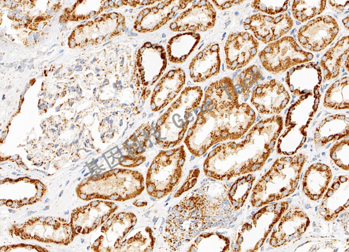 1724063916124115.jpg 1724063916124115.jpg